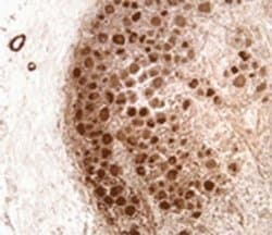 Neurofibromin 1 Antibody (McNFn27b) - Azide and BSA Free, Novus Biologicals